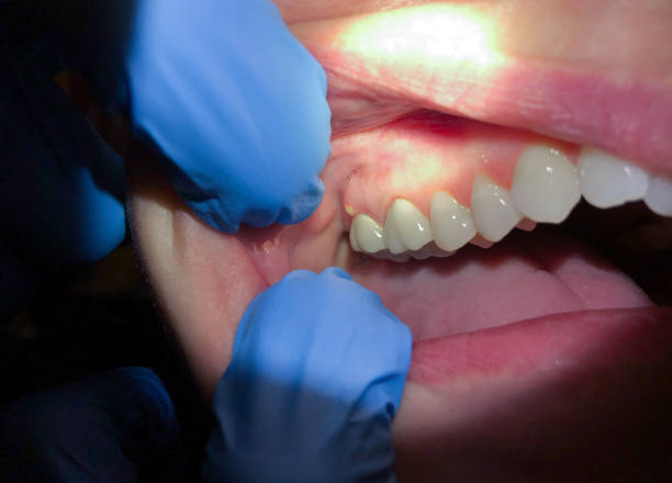 Best Pediatric Emergency Dentist in Zeigler, IL
