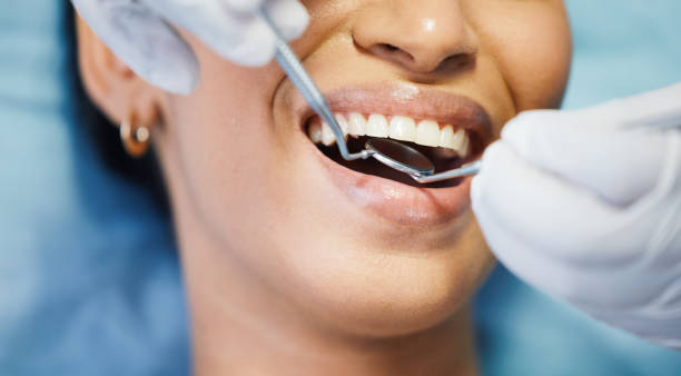 Best Emergency Tooth Extraction in Zeigler, IL